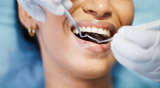 Best Emergency Dentist for Knocked-Out Tooth in South Holland, IL