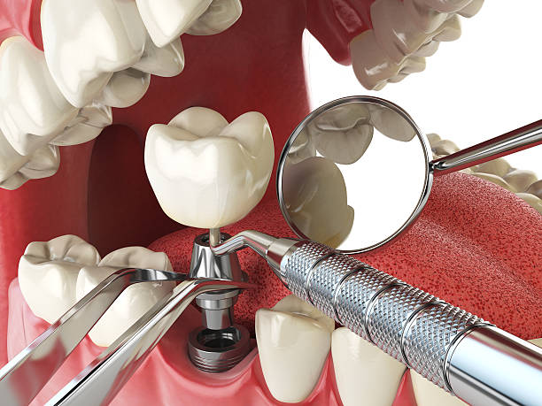 Best Emergency Dental Services for Seniors in South Holland, IL